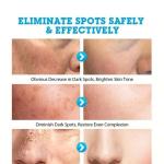 Mestin Anti-sun Spot Essence 30ml – Corrects Hyperpigmentation, Fades Dark Spots, Evens Skin Tone, 100% Natural Ingredients, Delays Aging