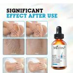 Mestin Anti-sun Spot Essence 30ml – Corrects Hyperpigmentation, Fades Dark Spots, Evens Skin Tone, 100% Natural Ingredients, Delays Aging